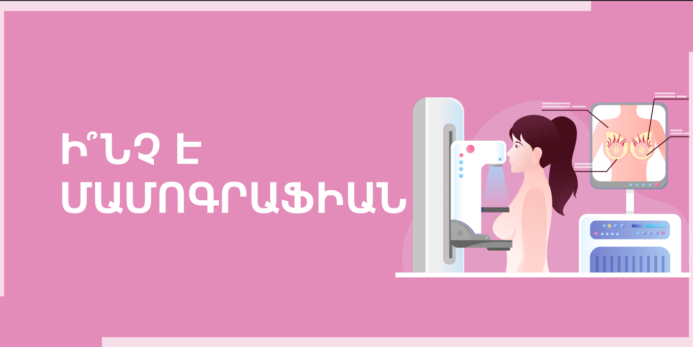 Ի՞նչ է մամոգրաֆիան։