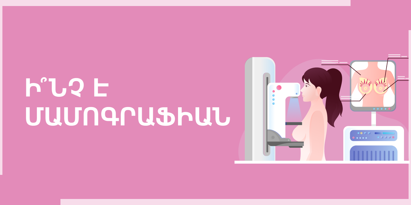 Ի՞նչ է մամոգրաֆիան։